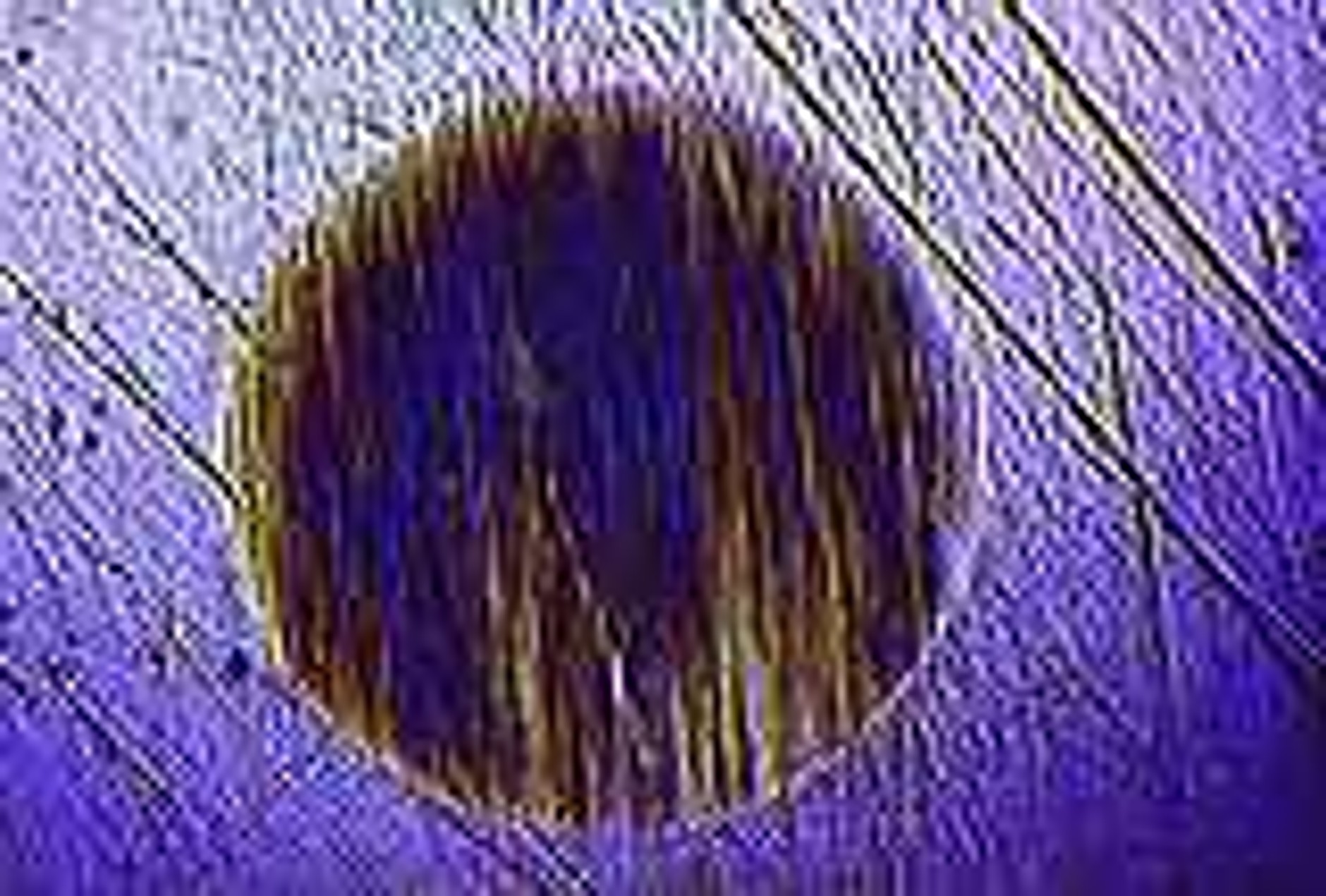 Nie zawsze winne są szczotki