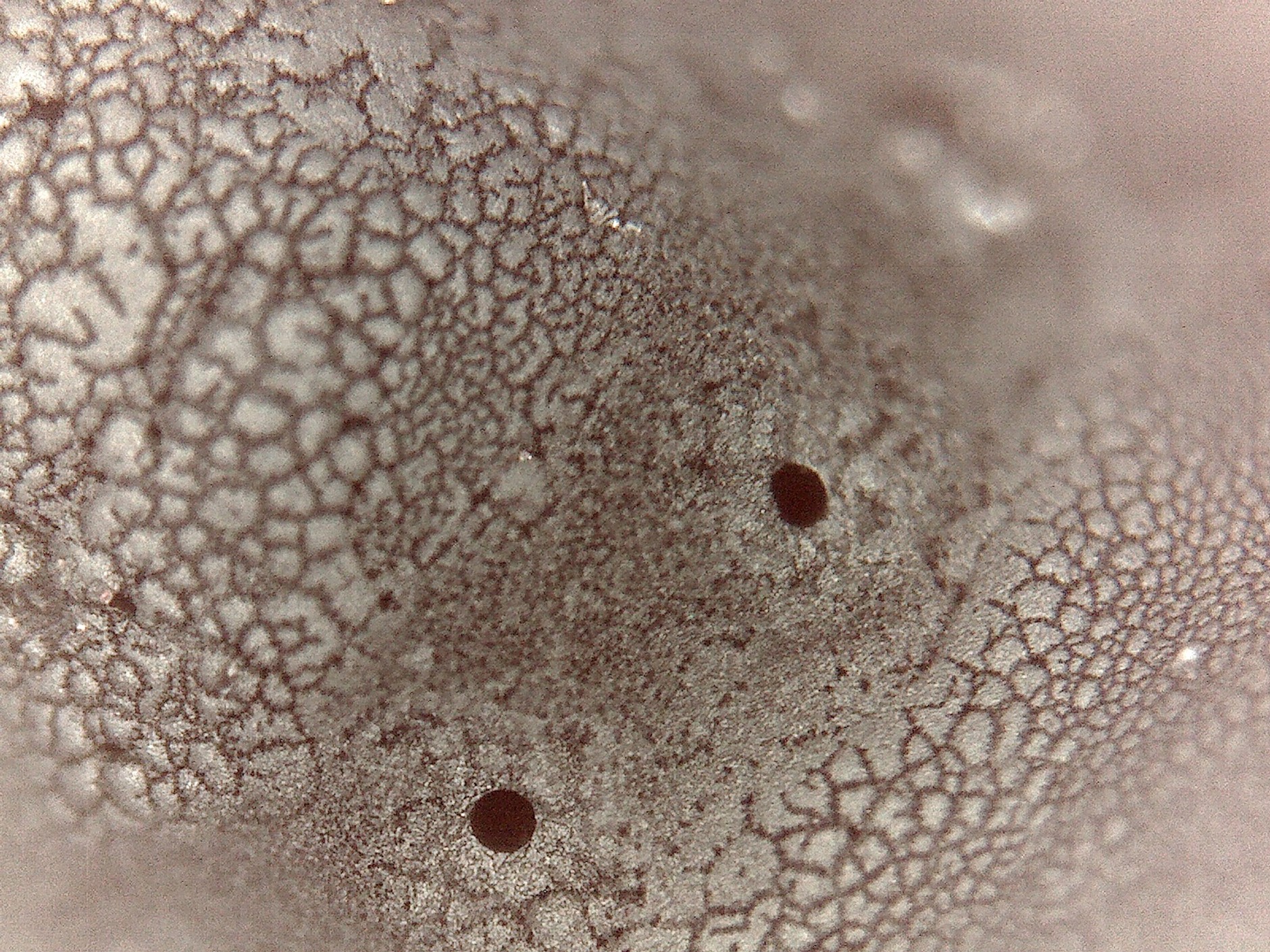 Samodzielne czyszczenie wtryskiwaczy: stan przed i po