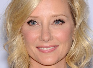 Anne Heche w stanie krytycznym po wypadku samochodowym. Jej auto stanęło w płomieniach
