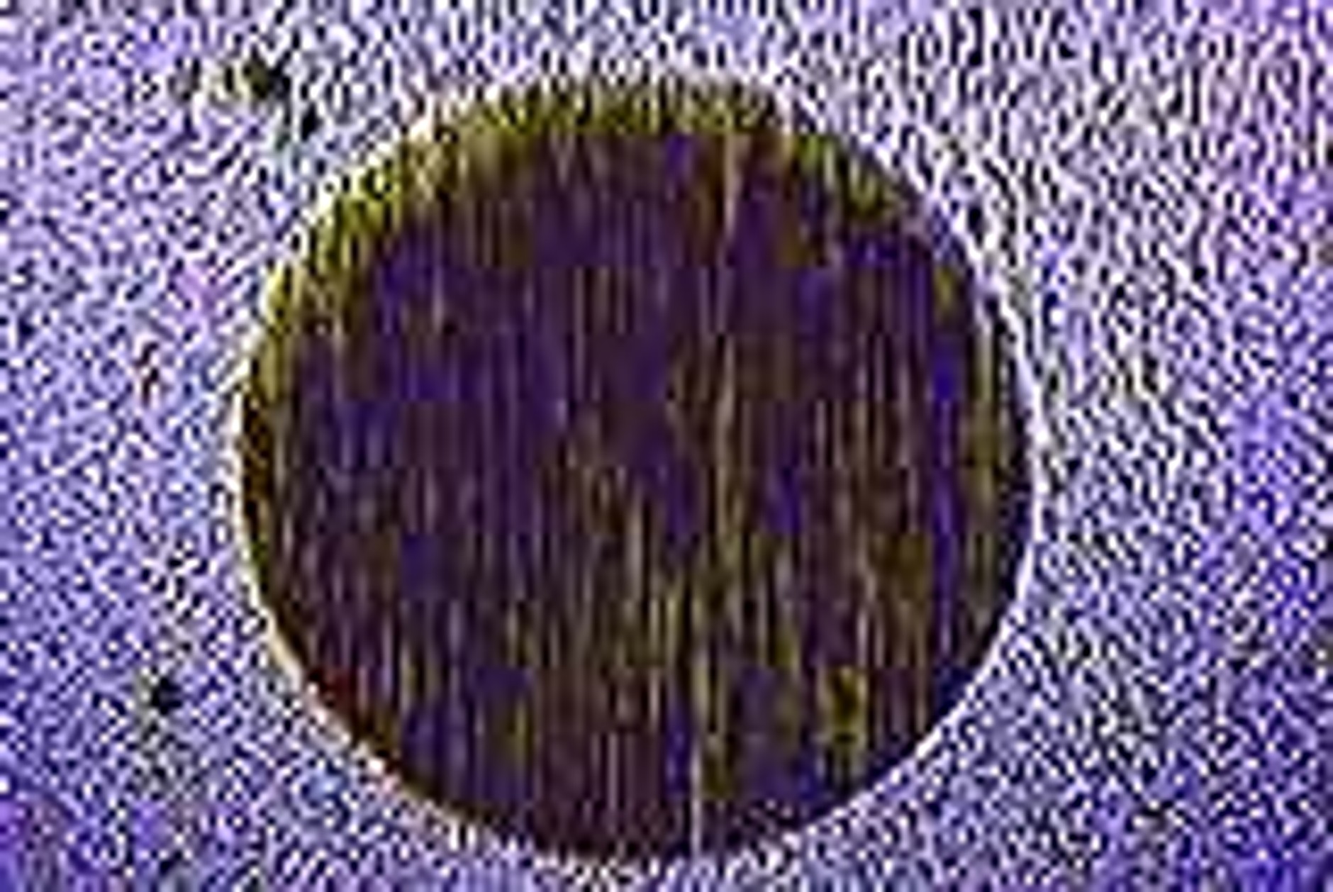 Nie zawsze winne są szczotki