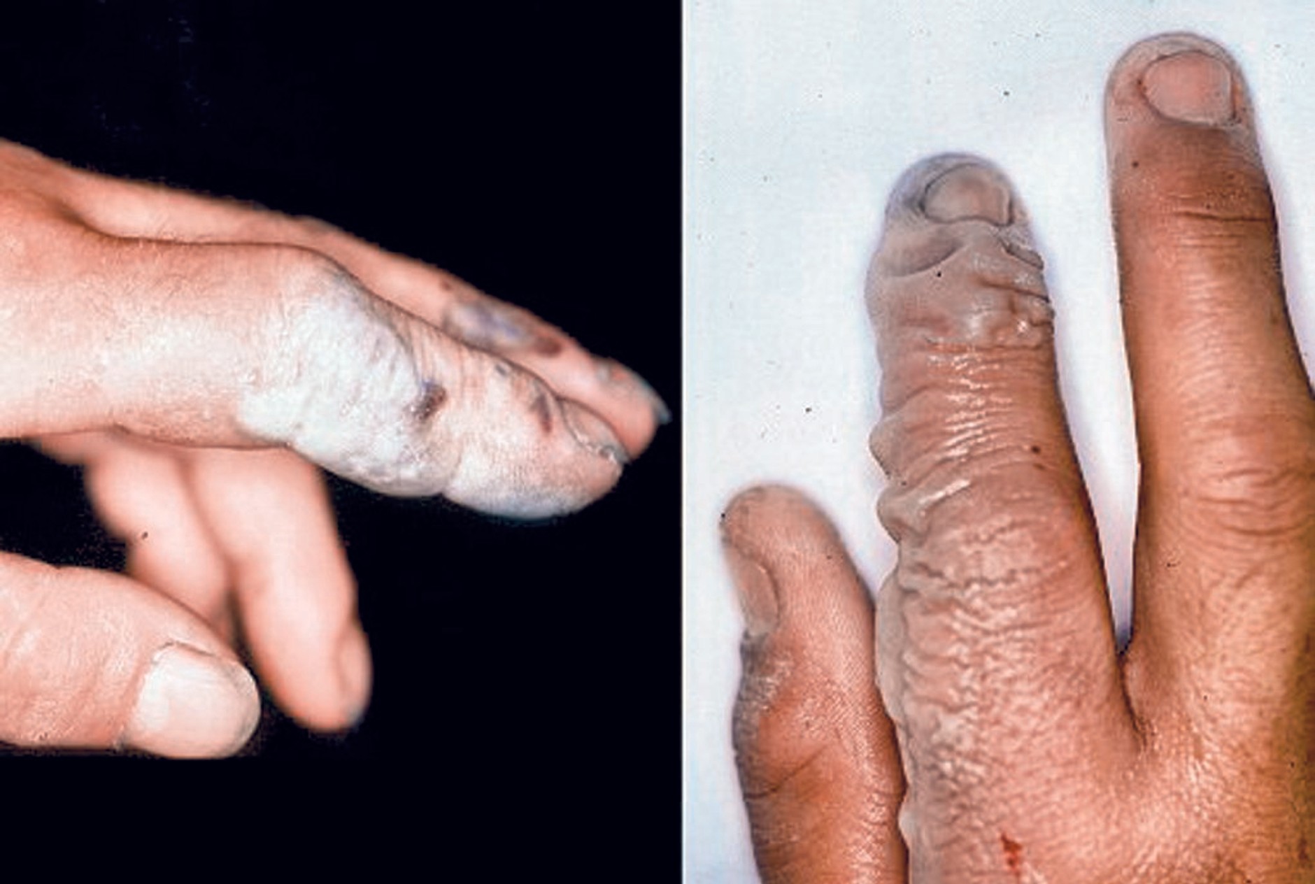 Ekologiczna groźna klima